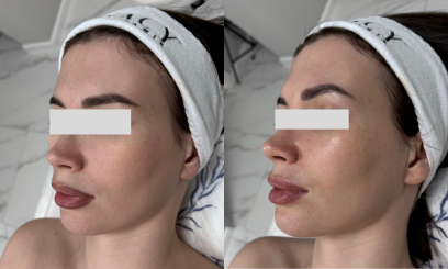 Уход "Огонь и Лед" от  Is Clinical